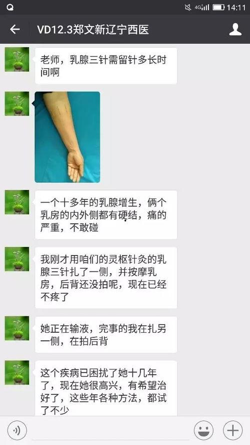针灸的视频教程,视频教学带你轻松掌握针灸技巧
